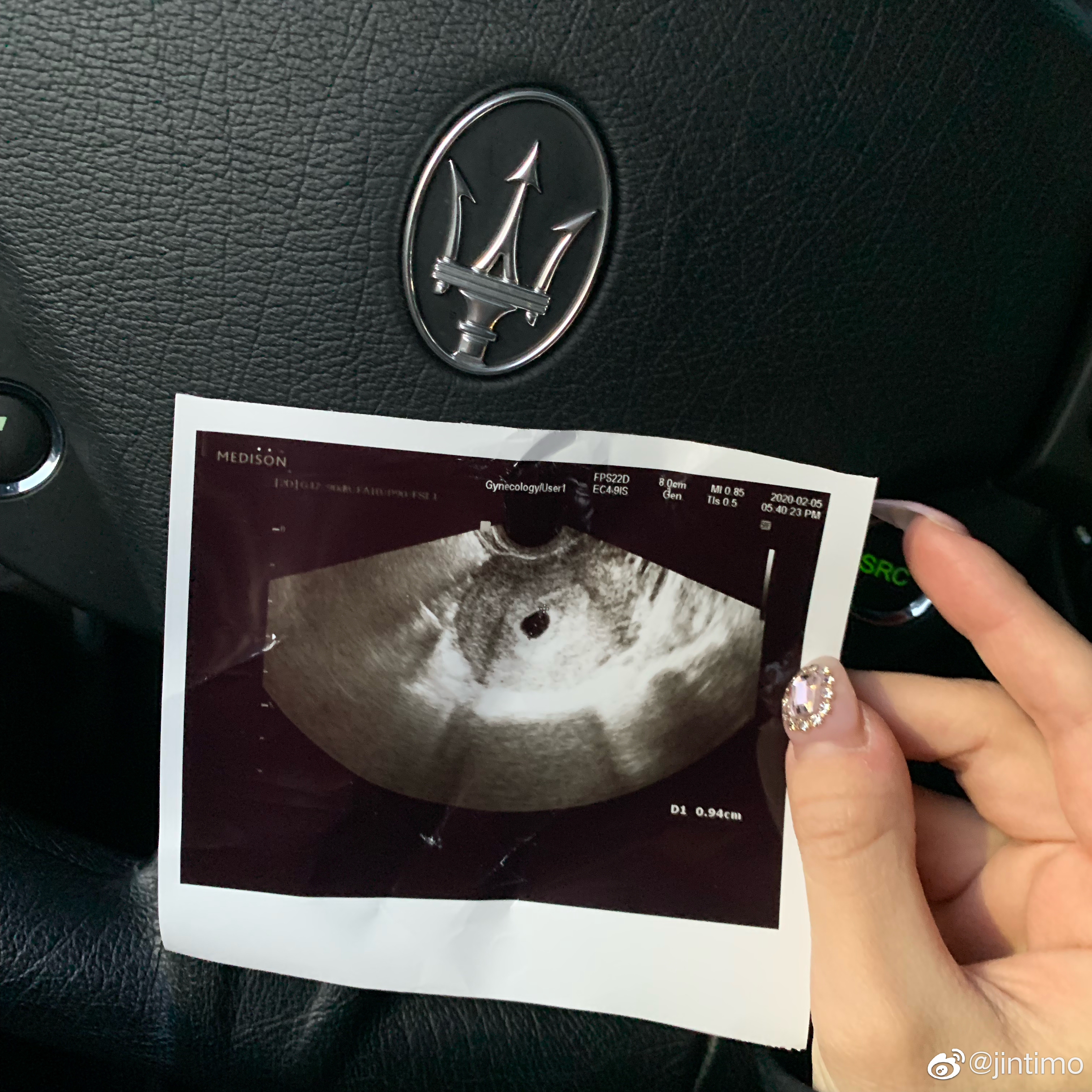 Mystic's wife posted an ultrasound photo on Weibo announcing that their family is about to welcome the fourth member