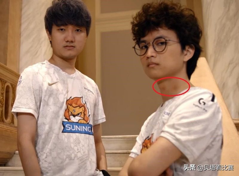 A strange mark on Huanfeng's neck is believed to be the 'result' of a night of romance.