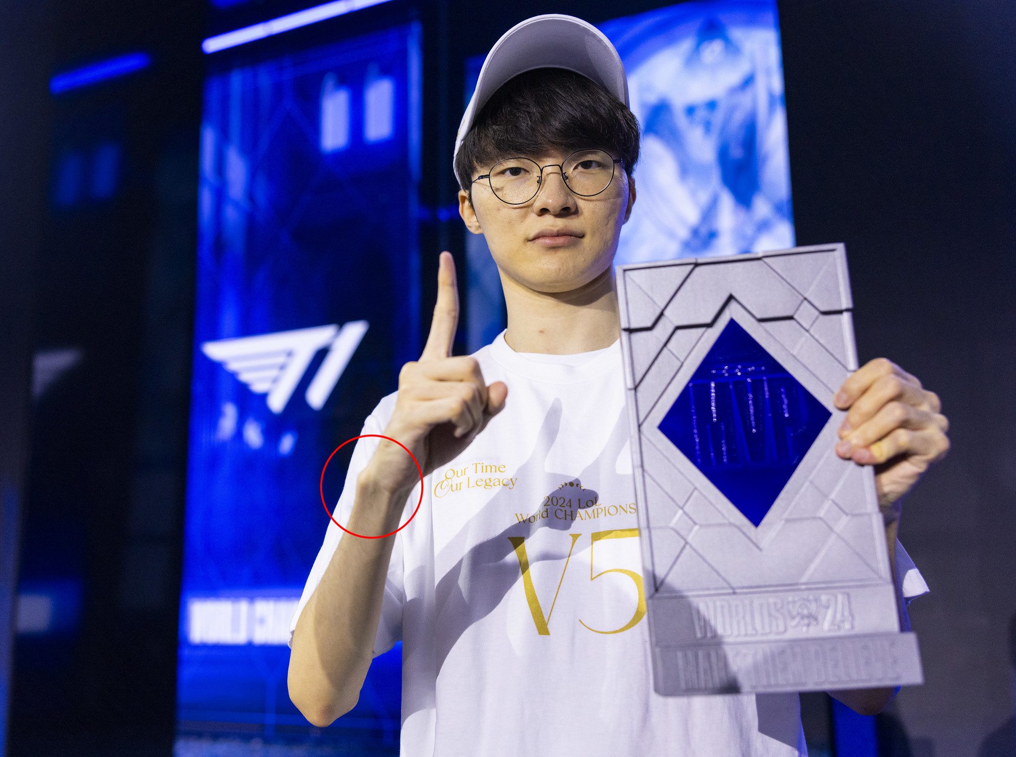 Faker's wrist joint is clearly protruding