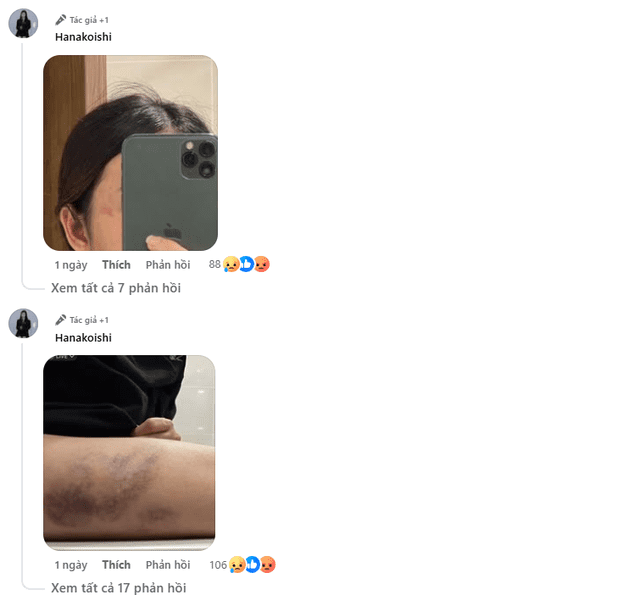 The female streamer posts photos of herself being abused.
